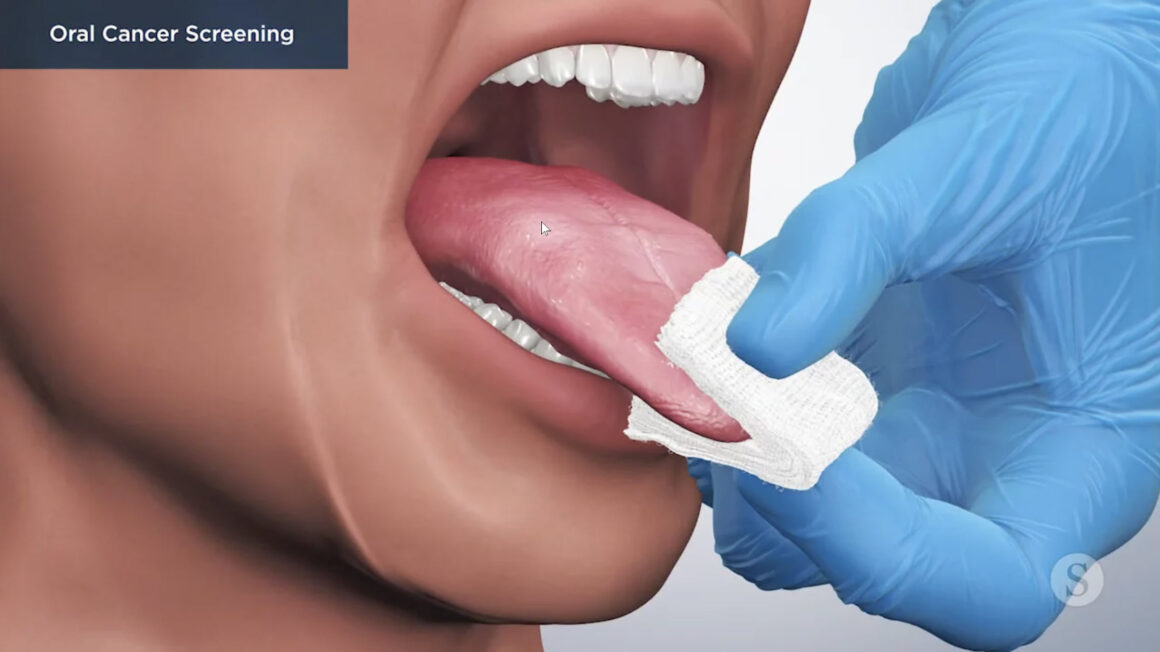 Oral Cancer Screening and Oral Pathology