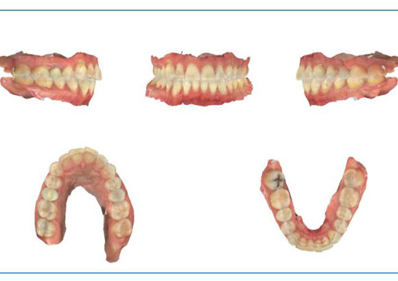 Digital Scanning